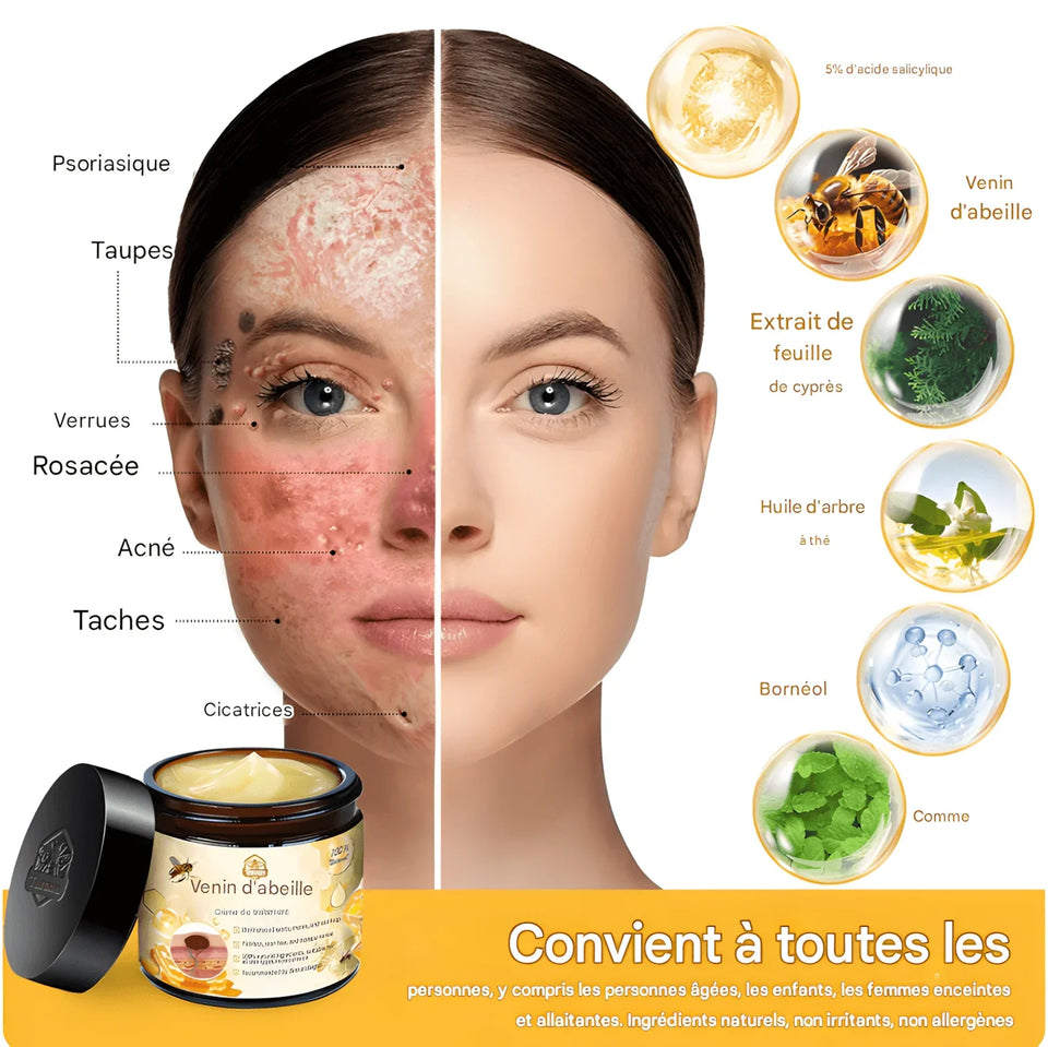 CRÈME AU VENIN D'ABEILLE – RÉVOLUTION SKINCARE