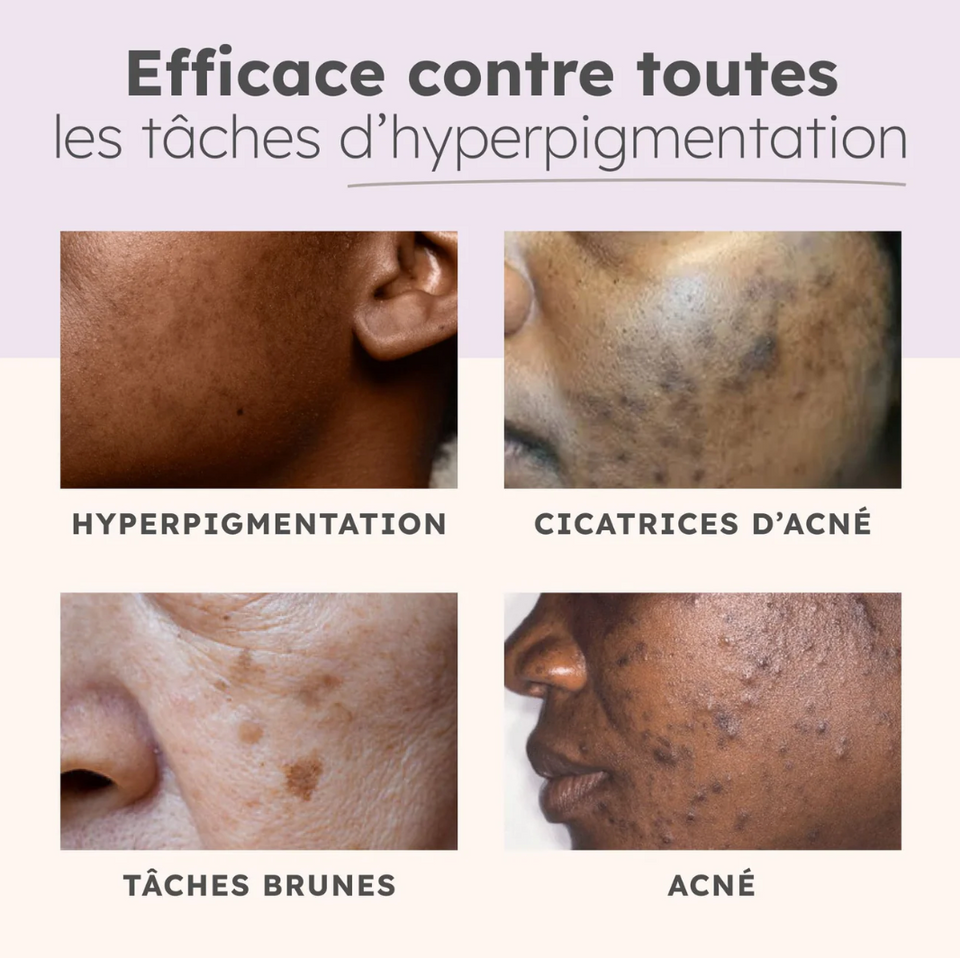 40 Cotons au Curcuma Anti-Imperfections