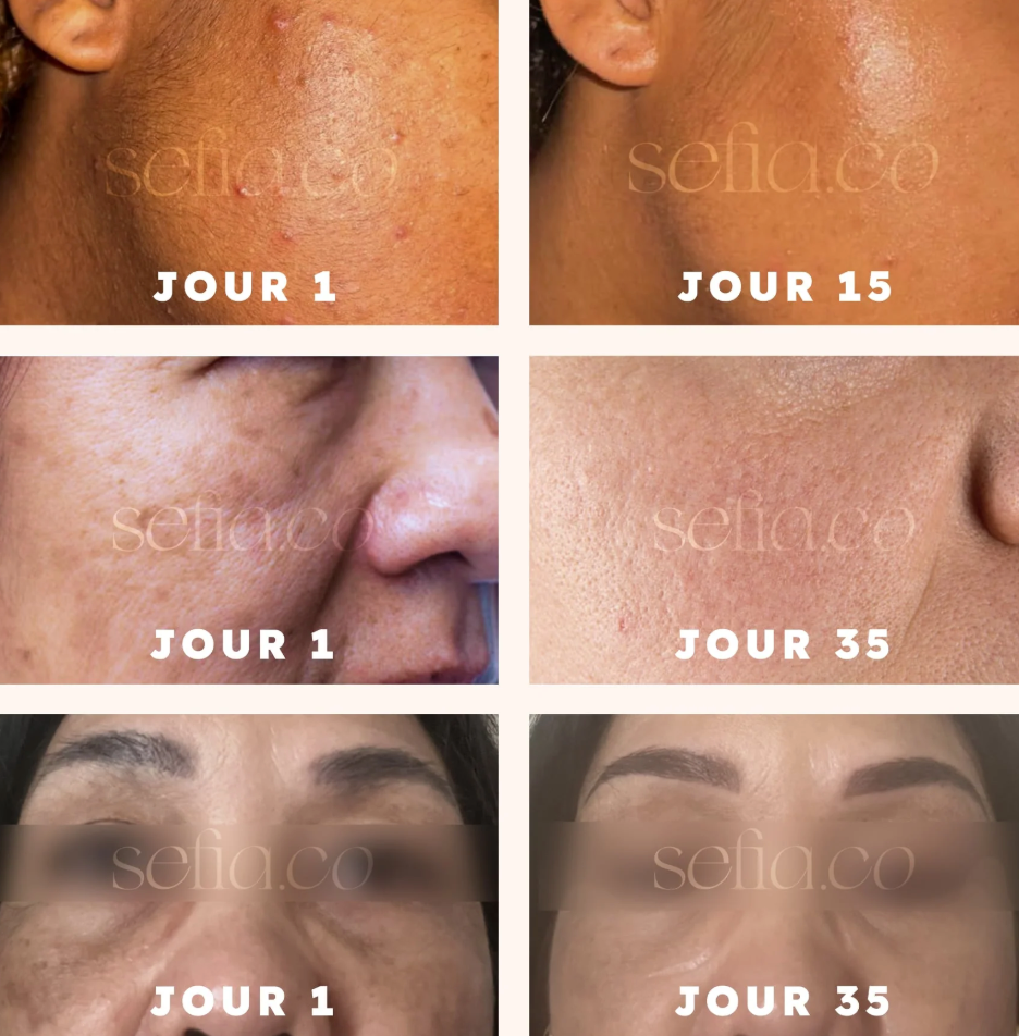 40 Cotons au Curcuma Anti-Imperfections