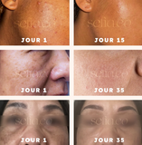 40 Cotons au Curcuma Anti-Imperfections