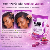 Hair Growth Accelerator - Gummies BINGO pour pousse de cheveux